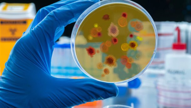 Oro uosto maliarijos atvejai Europoje, laboratorijoje tiriamas mikroorganizmų mėginys