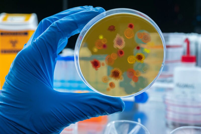 Oro uosto maliarijos atvejai Europoje, laboratorijoje tiriamas mikroorganizmų mėginys