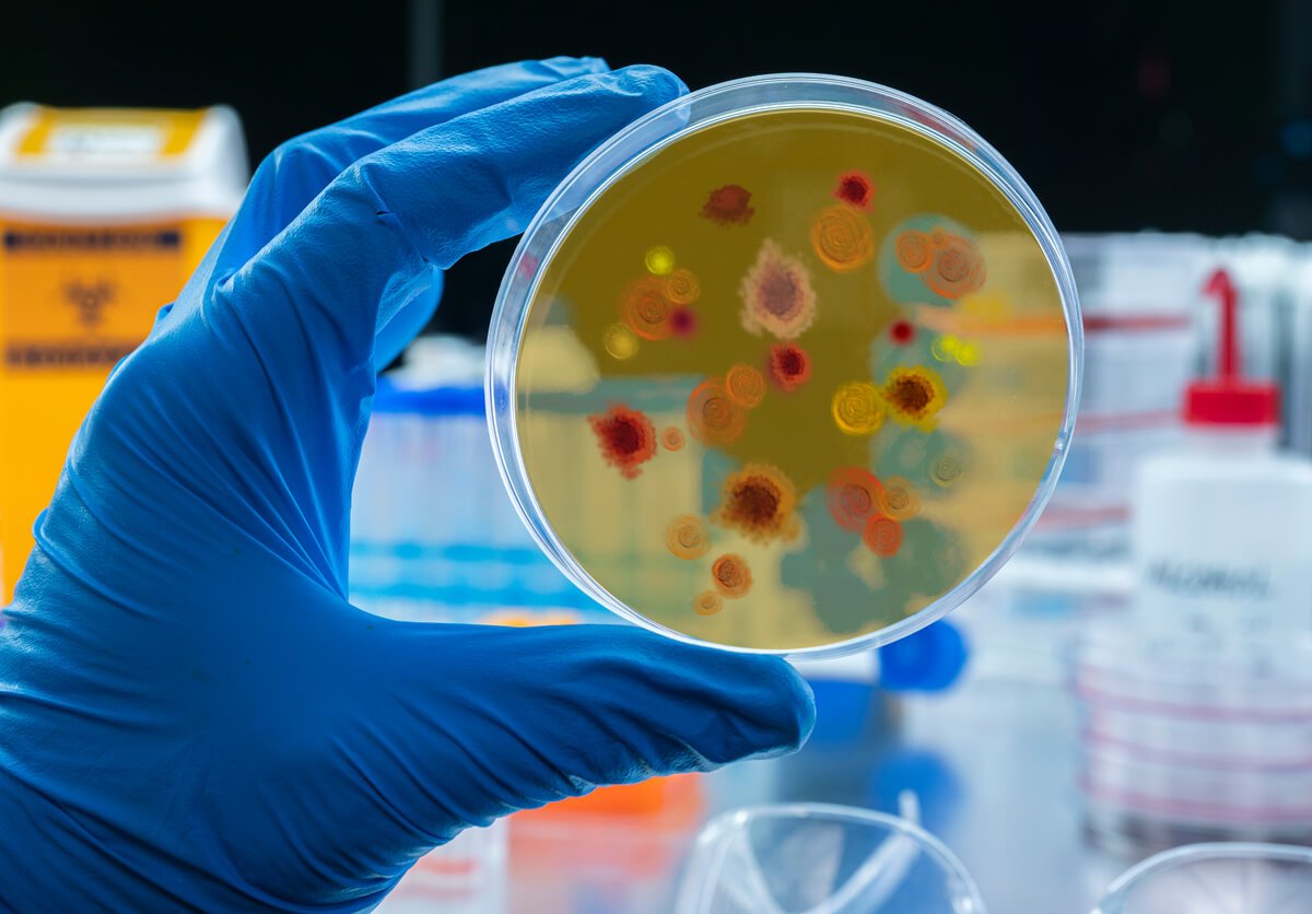 Oro uosto maliarijos atvejai Europoje, laboratorijoje tiriamas mikroorganizmų mėginys